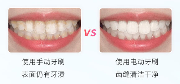 电动牙刷,舒客电动牙刷,充电式牙刷,智能声波电动牙刷,Saky电动牙刷,舒客G32